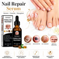NailRevive® – Advanced Nail Repair Serum